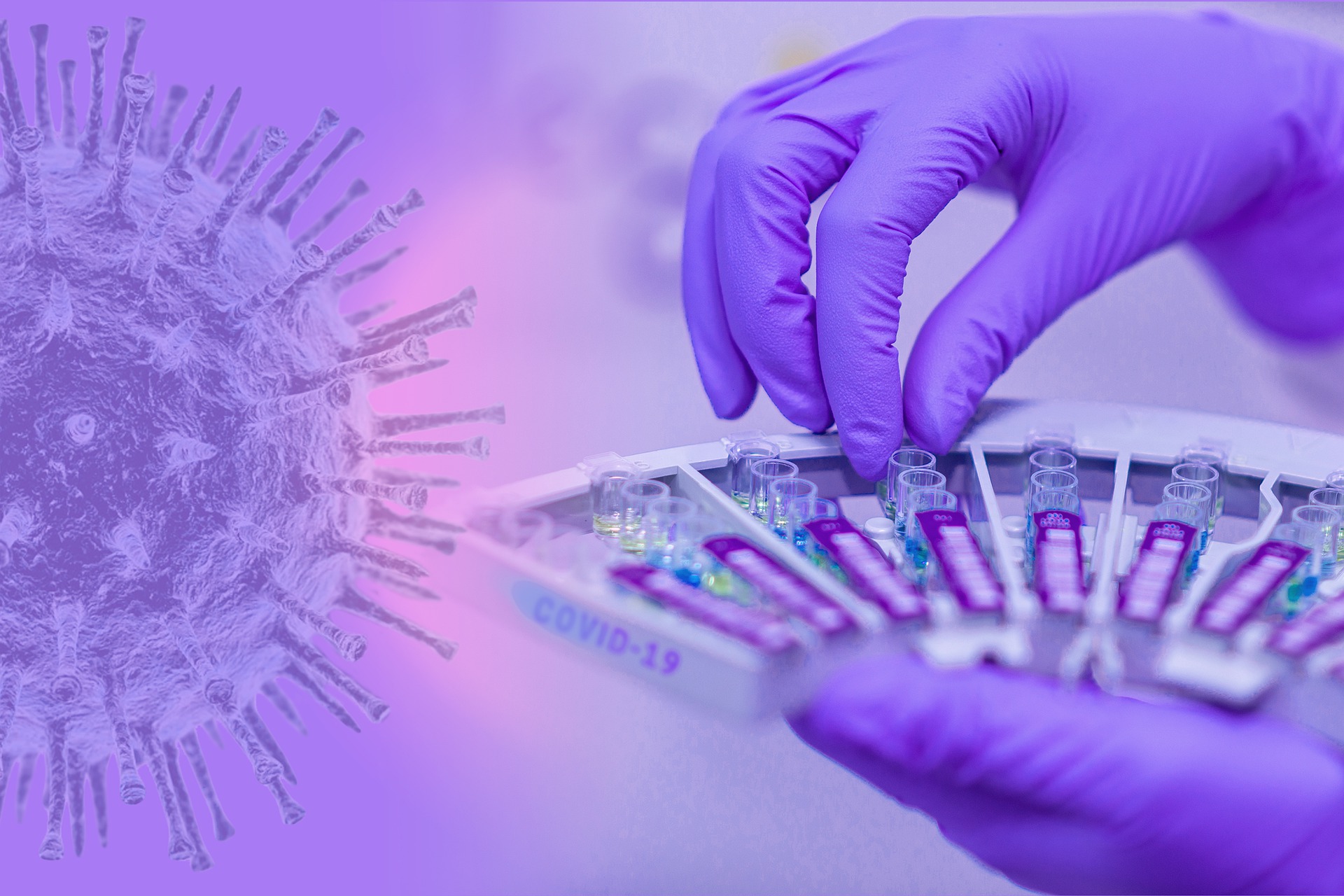 Kit SARS-CoV2-RT PCR